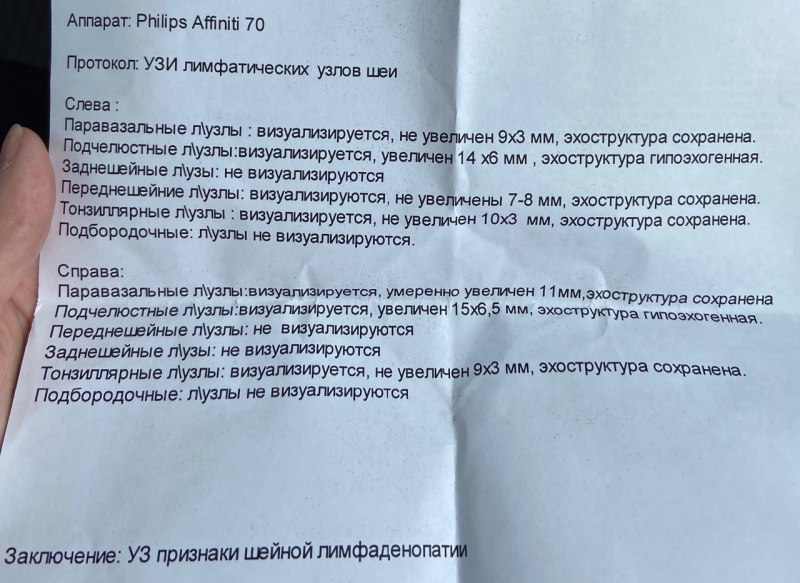 УЗИ лимфатических узлов подчелюстных лимфоузлов норма